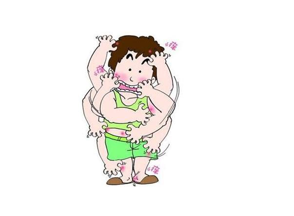 哈尔滨肤康皮肤病医院6岁多的孩子为何得荨麻疹！<